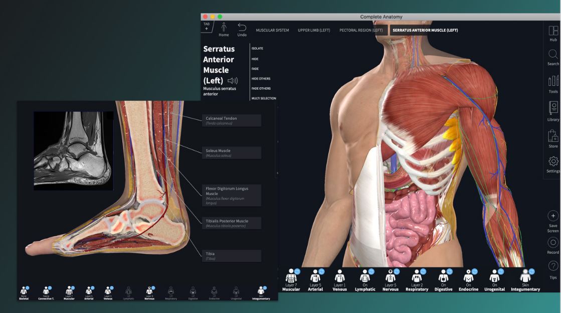 Complete Anatomy